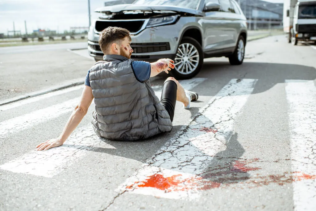 A man sitting on the road near a crosswalk, injured after being struck by a car.