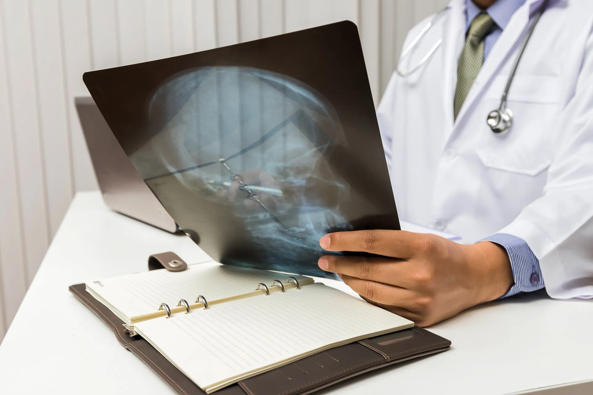 A doctor in a white coat reviewing an X-ray scan at their desk.