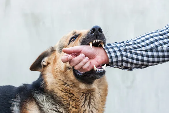 Dog biting person's arm